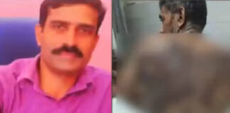 വീട്ടിലെത്തിയ സഹോദരന്റെ സുഹൃത്തിന് നേരെ ആസിഡ് ആക്രമണം ; പ്രതി പിടിയിൽ