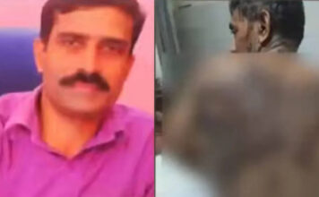 വീട്ടിലെത്തിയ സഹോദരന്റെ സുഹൃത്തിന് നേരെ ആസിഡ് ആക്രമണം ; പ്രതി പിടിയിൽ