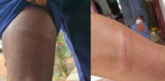 പുന്നമൂട് ഹയർസെക്കൻഡറി സ്കൂളിലെ വിദ്യാർഥികൾക്കുനേരെ പോലീസ് മർദ്ദനം