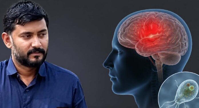 കോഴിക്കോട് അമീബിക് മസ്തിഷ്കജ്വരം ബാധിച്ച് യുവാവിന് ദാരുണാന്ത്യം കോഴിക്കോട് അമീബിക് മസ്തിഷ്കജ്വരം ബാധിച്ച് യുവാവിന് ദാരുണാന്ത്യം