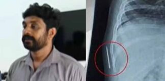 ഒരു വയസുകാരിയുടെ ശരീരത്തില് സൂചി കുടുങ്ങിയ സംഭവം : കോട്ടയം മെഡിക്കൽ കോളജിൽ നിന്ന് തന്നെയാണ് സൂചി കയറിയത് : കുഞ്ഞിന്റെ പിതാവ് വിനീഷ്