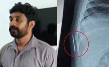 ഒരു വയസുകാരിയുടെ ശരീരത്തില് സൂചി കുടുങ്ങിയ സംഭവം : കോട്ടയം മെഡിക്കൽ കോളജിൽ നിന്ന് തന്നെയാണ് സൂചി കയറിയത് : കുഞ്ഞിന്റെ പിതാവ് വിനീഷ്