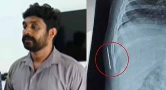 ഒരു വയസുകാരിയുടെ ശരീരത്തില് സൂചി കുടുങ്ങിയ സംഭവം : കോട്ടയം മെഡിക്കൽ കോളജിൽ നിന്ന് തന്നെയാണ് സൂചി കയറിയത് : കുഞ്ഞിന്റെ പിതാവ് വിനീഷ് ഒരു വയസുകാരിയുടെ ശരീരത്തില് സൂചി കുടുങ്ങിയ സംഭവം : കോട്ടയം മെഡിക്കൽ കോളജിൽ നിന്ന് തന്നെയാണ് സൂചി കയറിയത് : കുഞ്ഞിന്റെ പിതാവ് വിനീഷ്