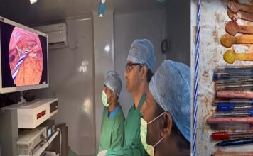കടുത്ത വയറുവേദനയെ തുടർന്ന് ആശുപത്രിയിൽ പ്രവേശിപ്പിച്ച യുവതിയുടെ വയറ്റിൽനിന്ന് പുറത്തെടുത്തത് 14 പേനകളും അഞ്ച് സ്പൂണുകളും ഒരു മെഴുകുതിരിയും