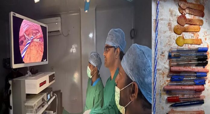 കടുത്ത വയറുവേദനയെ തുടർന്ന് ആശുപത്രിയിൽ പ്രവേശിപ്പിച്ച യുവതിയുടെ വയറ്റിൽനിന്ന് പുറത്തെടുത്തത് 14 പേനകളും അഞ്ച് സ്പൂണുകളും ഒരു മെഴുകുതിരിയും കടുത്ത വയറുവേദനയെ തുടർന്ന് ആശുപത്രിയിൽ പ്രവേശിപ്പിച്ച യുവതിയുടെ വയറ്റിൽനിന്ന് പുറത്തെടുത്തത് 14 പേനകളും അഞ്ച് സ്പൂണുകളും ഒരു മെഴുകുതിരിയും